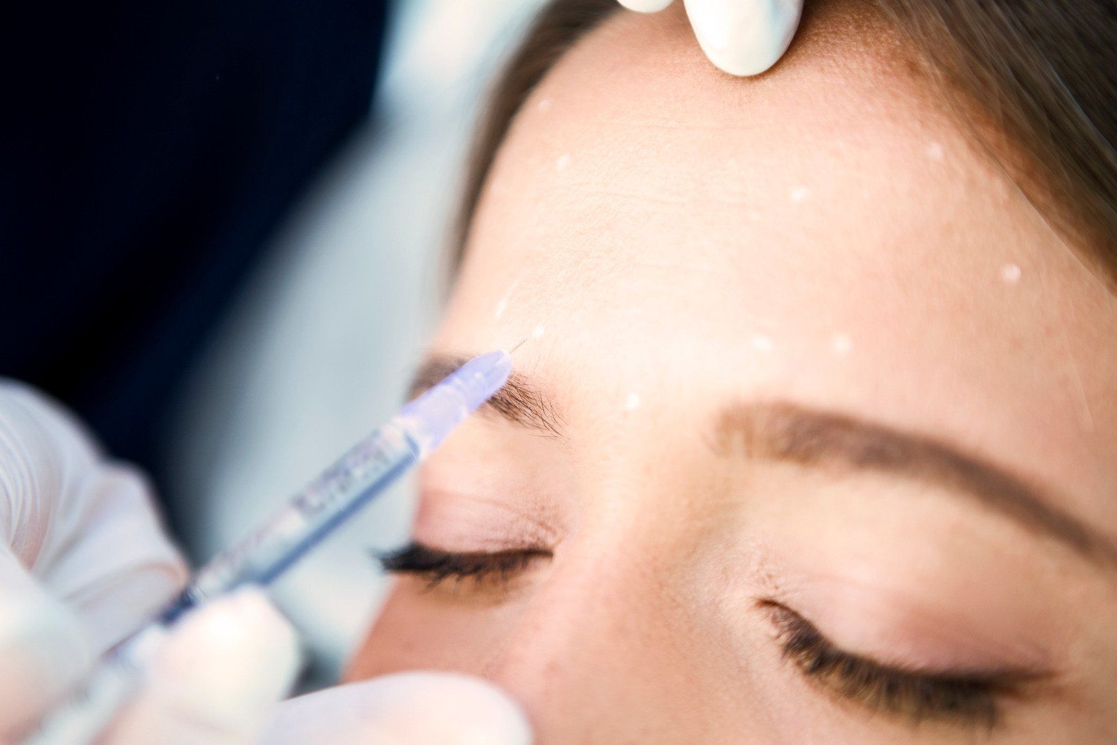 Botox