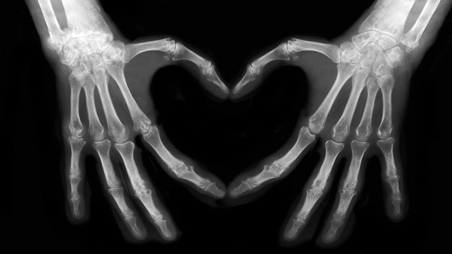 X-ray of two hands forming a heart shape against a black background