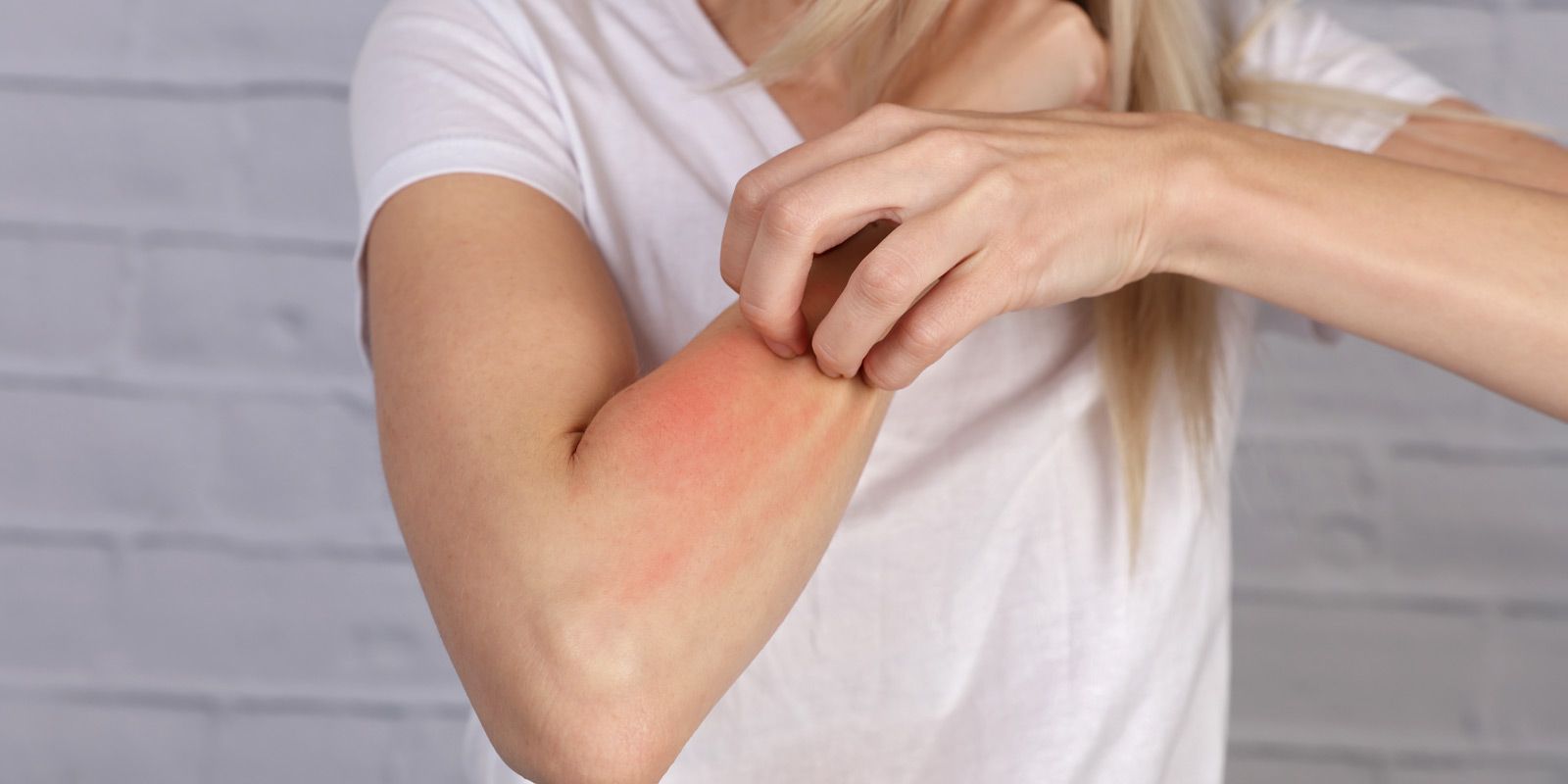 Allergy Clearing Technique NYC - Dr. Alicia Armitstead. Accelerated Allergy Clearing at Healing Arts NYC Health and Wellness Center in Manhattan NY 10017