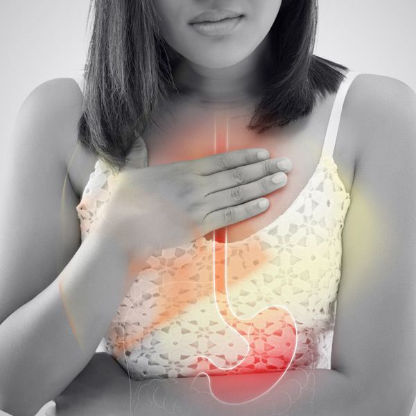 Barrett's Esophagus