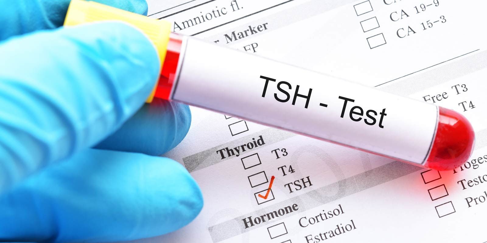 Hashimoto's Thyroiditis Remedies NYC - Dr. Alicia Armitstead. Natural Remedies for Hashimoto's Thyroiditis at the Healing Arts NYC Health and Wellness Center in Manhattan NY 10017 and Connecticut