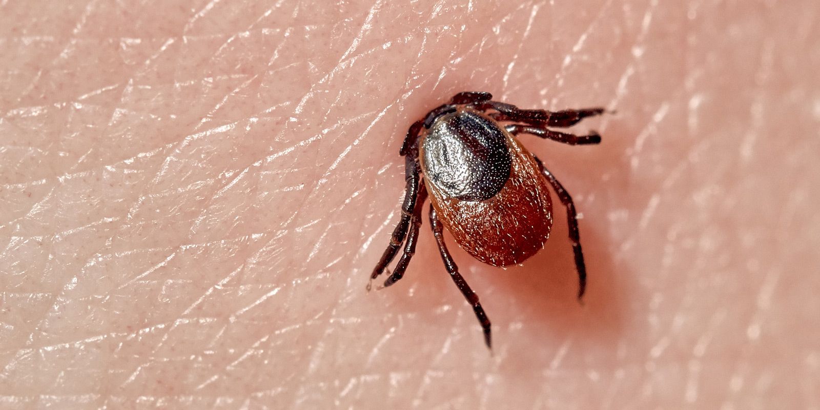 Lyme Disease Remedies NYC - Dr. Alicia Armitstead. Natural Remedies for Lyme Disease at the Healing Arts NYC Health and Wellness Center in Manhattan NY 10017 and Connecticut