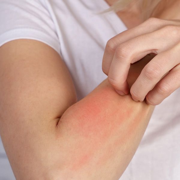 Allergy Clearing