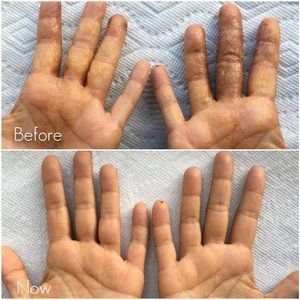 Hands stained with something, before and after washing.