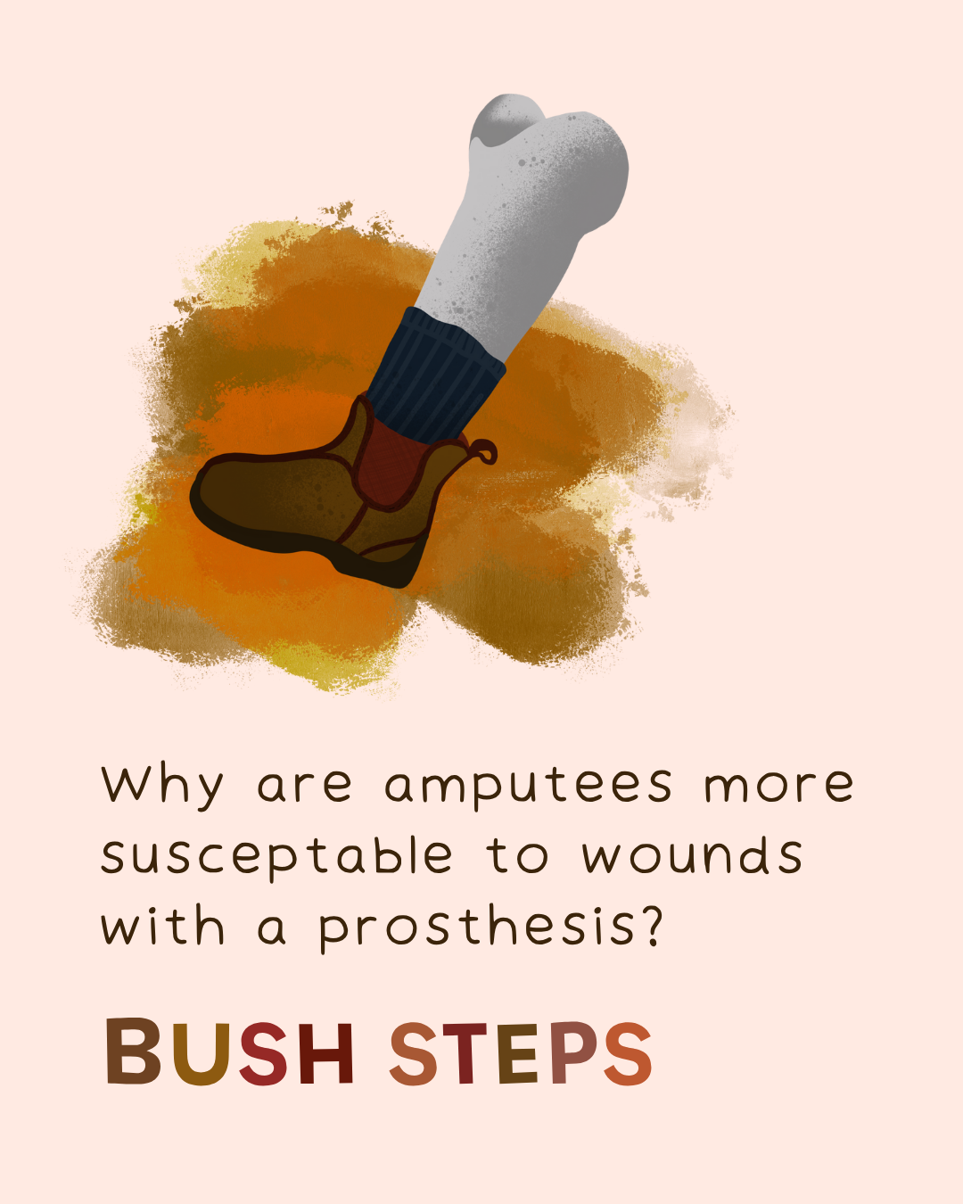 Illustration of a leg prosthesis in a boot.
