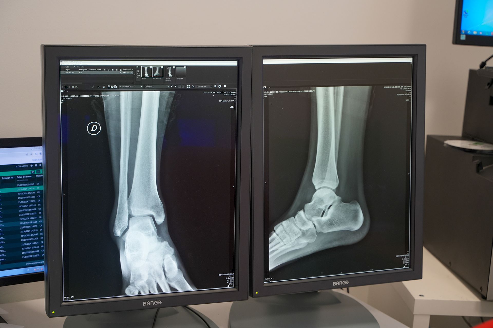 radiologia digitale