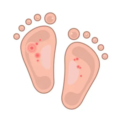 Due impronte di piedi rosa con piccoli puntini rossi sulle dita, su sfondo bianco.