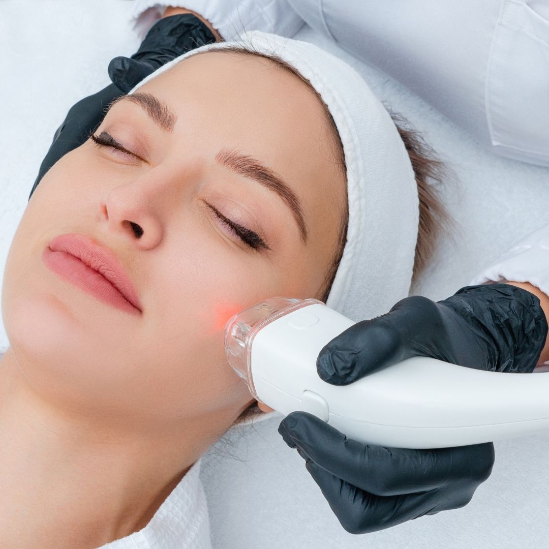 Acne Treatments treatment at Renewed Health and Wellness in Prospect, Connecticut