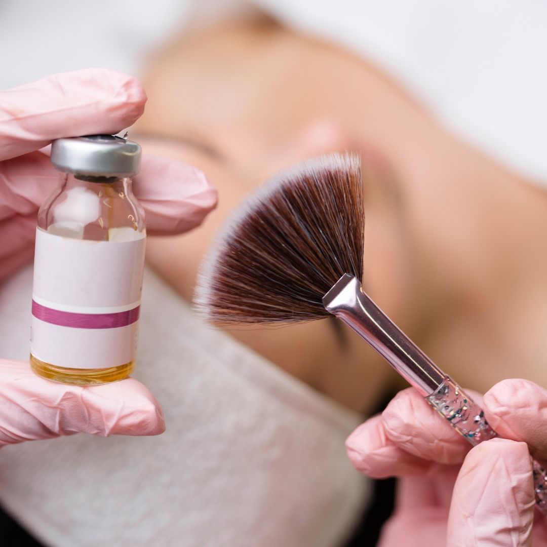 Chemical Peels treatment at Renewed Health and Wellness in Prospect, Connecticut