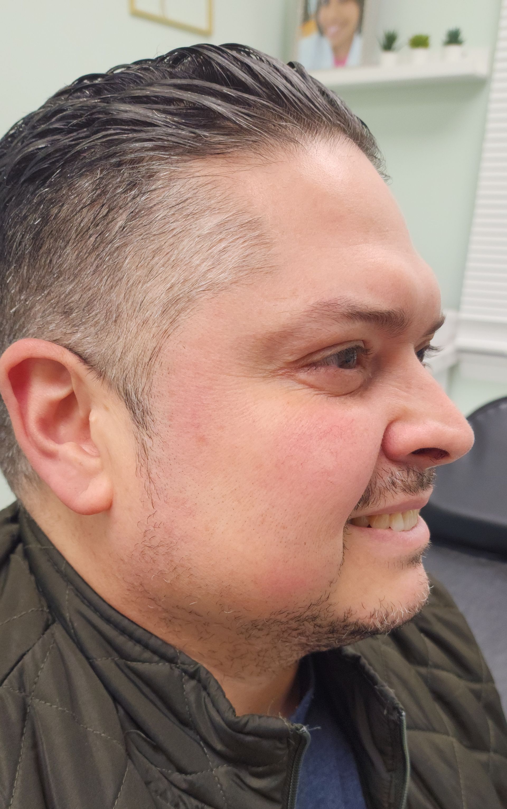 After treatment result at Renewed Health and Wellness