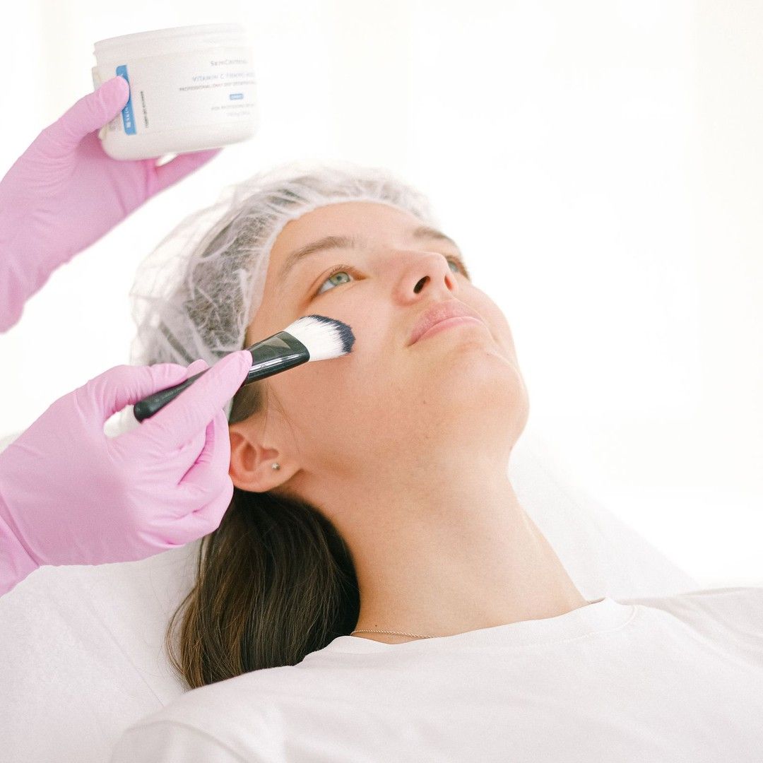 A pigmentation treatment being applied at Renewed Health and Wellness in Prospect, Connecticut