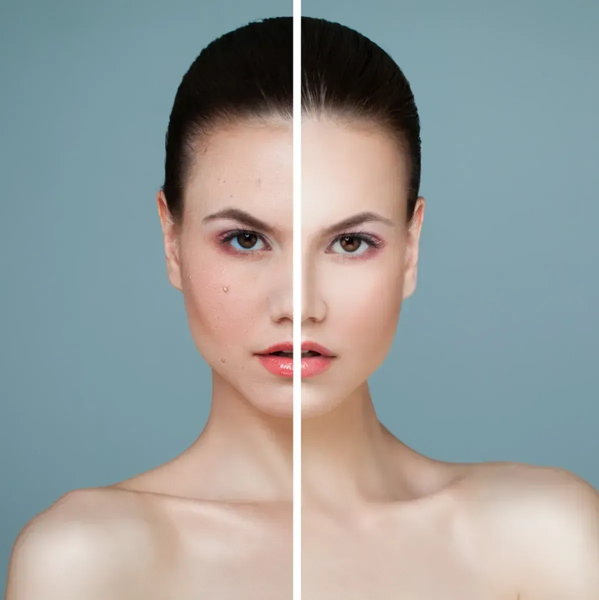 Meso-Glow Package at Renewed Health and Wellness in Prospect, Connecticut