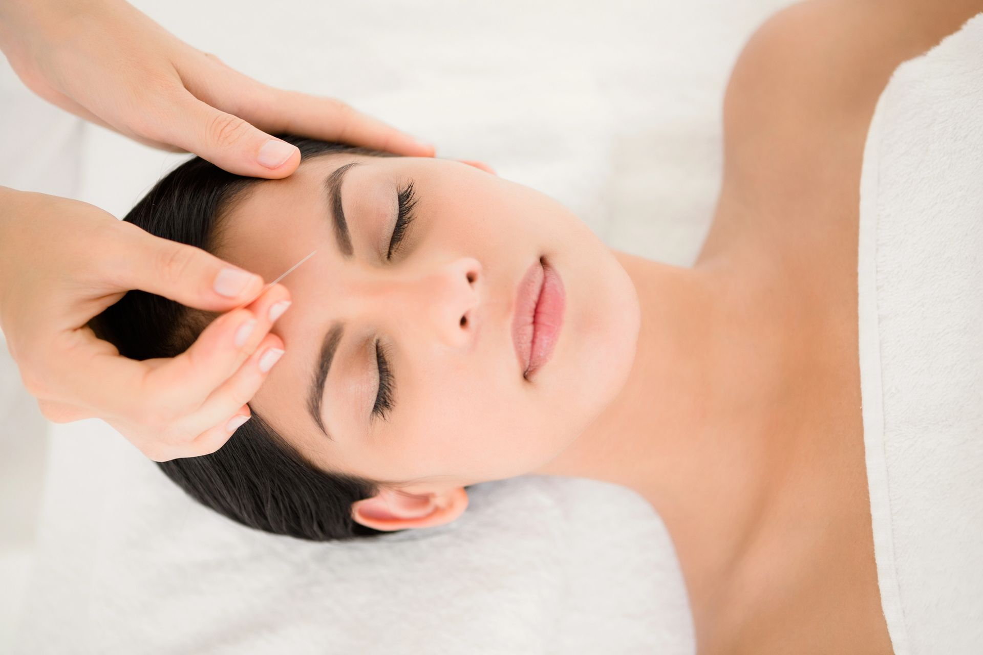 Acupuncture in Sheboygan, WI Acupuncture in Sheboygan, WI