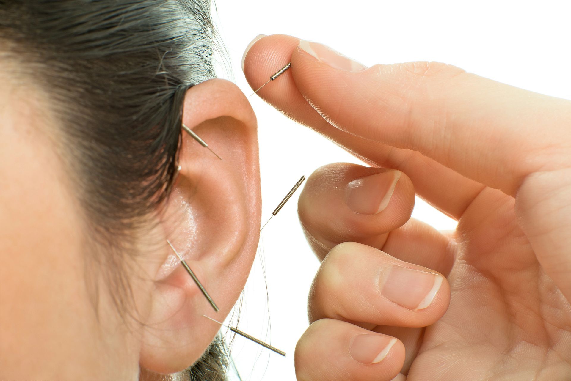 Soliman Auricular Allergy Treatment in Sheboygan, WI Soliman Auricular Allergy Treatment in Sheboygan, WI