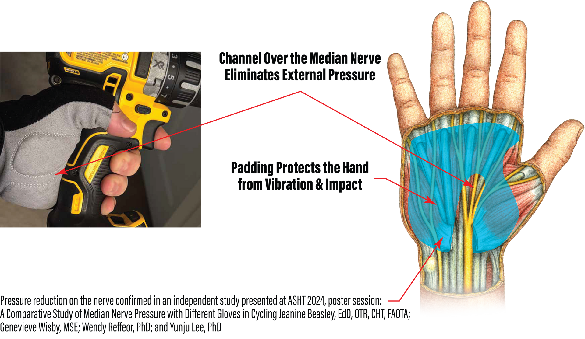 shocktek gloves, median nerve, how it works,