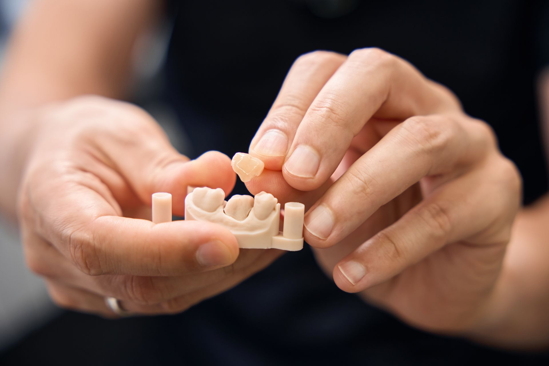 Hands holding a small, 3D-printed model of teeth and a single crown piece