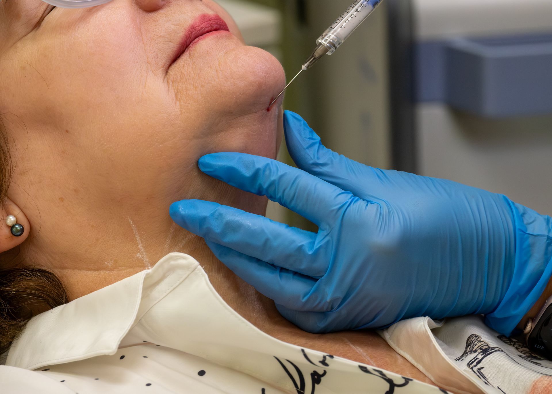Gloved clinician preparing an injection near a patient's chin and neck