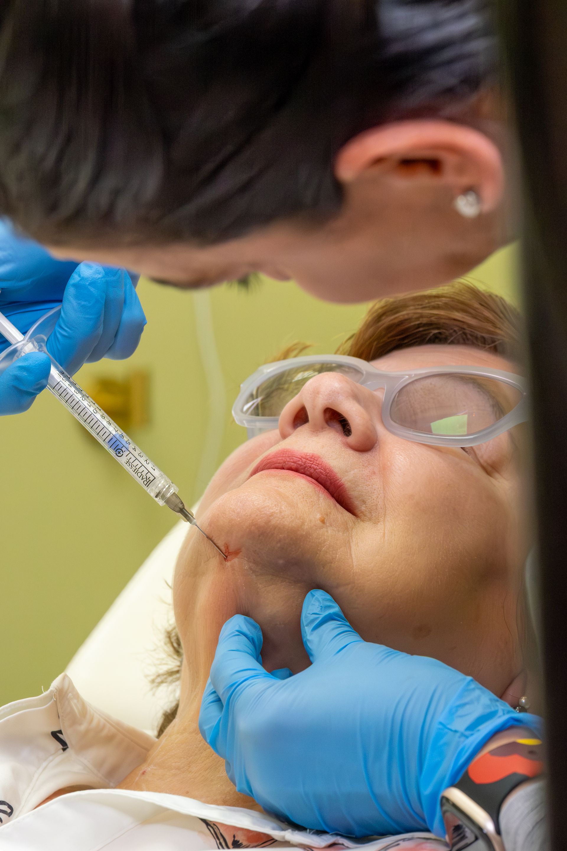 A gloved clinician injects a patient's chin during a cosmetic treatment, with another person assisting nearby.