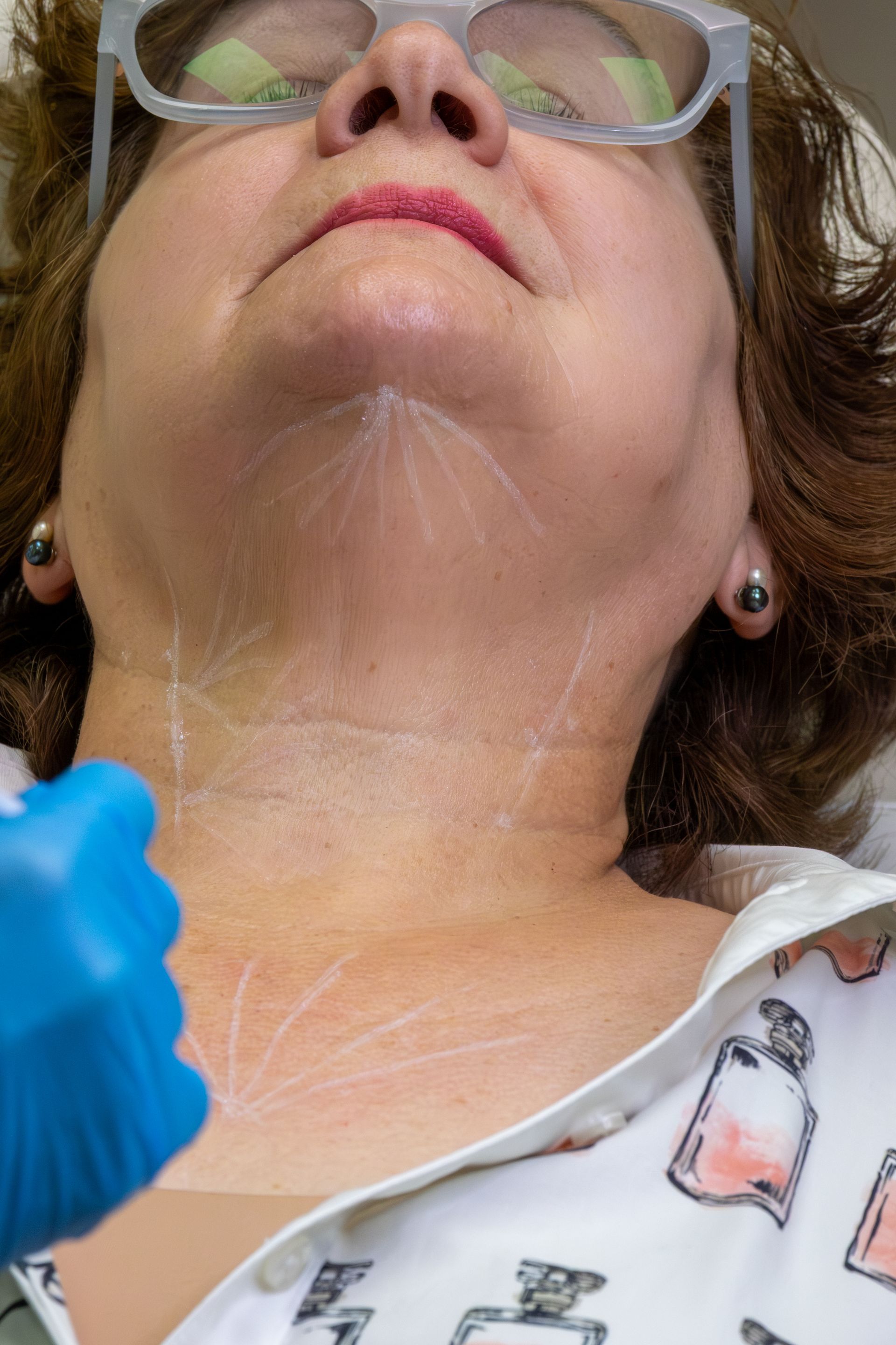 Person reclines with chin raised while a blue-gloved hand works on the neck under the jawline.