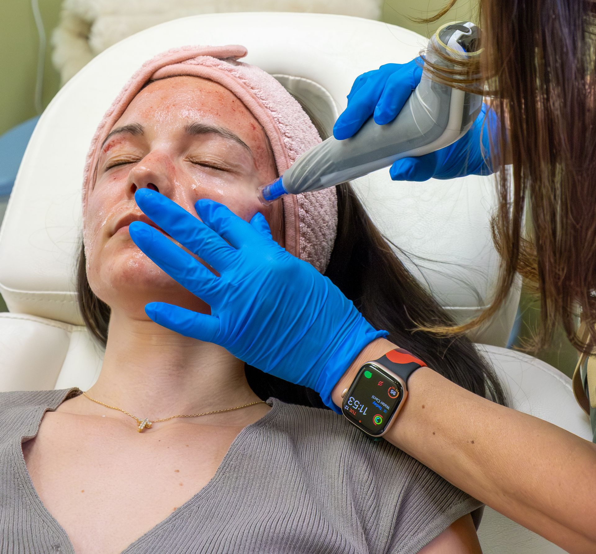 Cosmetic treatment on a woman's cheek with a handheld device and gloved hands in a clinic