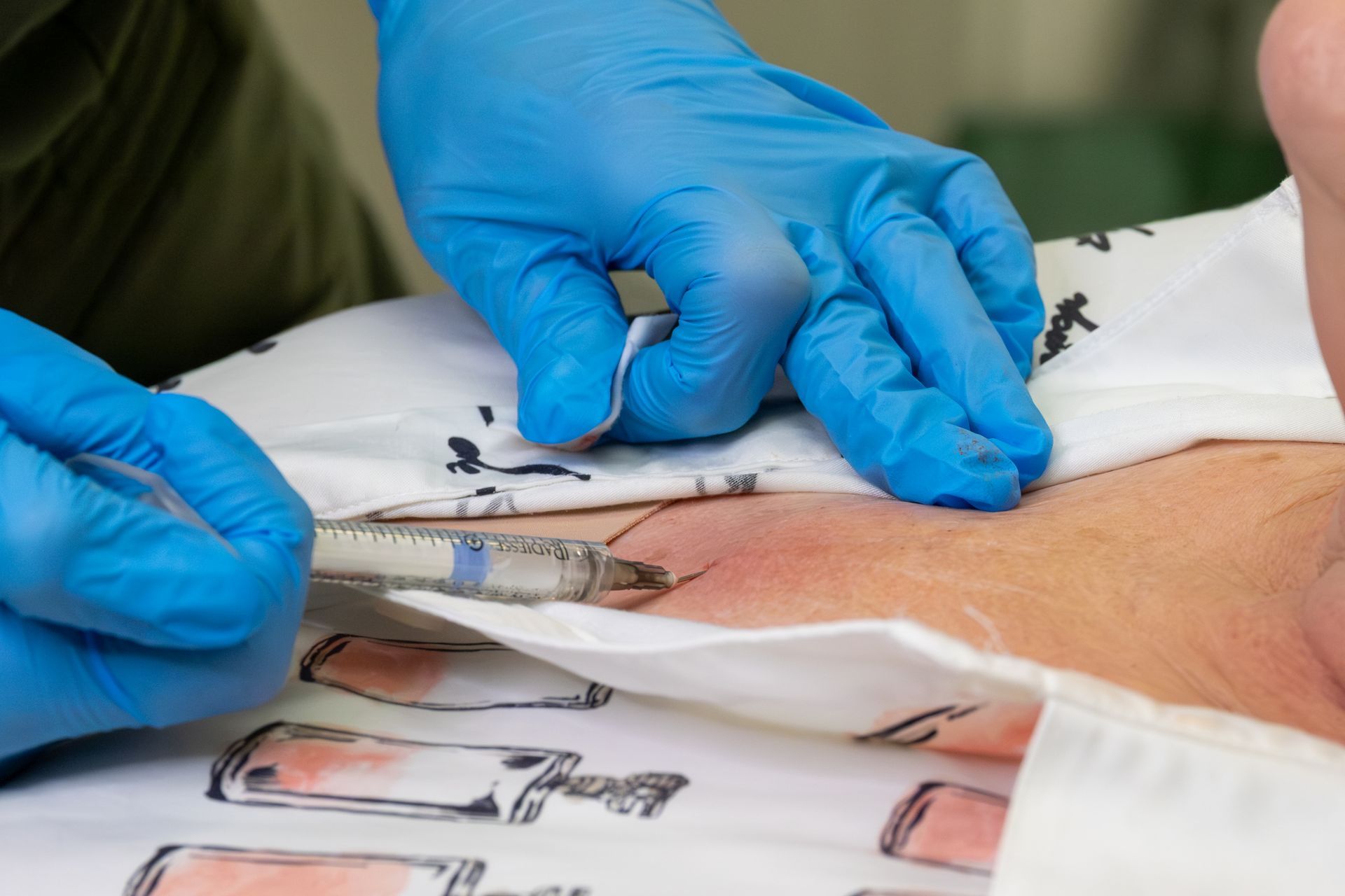 Gloved hands performing a medical skin procedure with a syringe on a patient’s arm