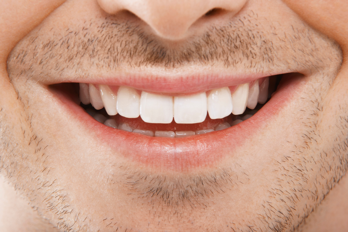 Close-up of a smiling man with white teeth and a light mustache.