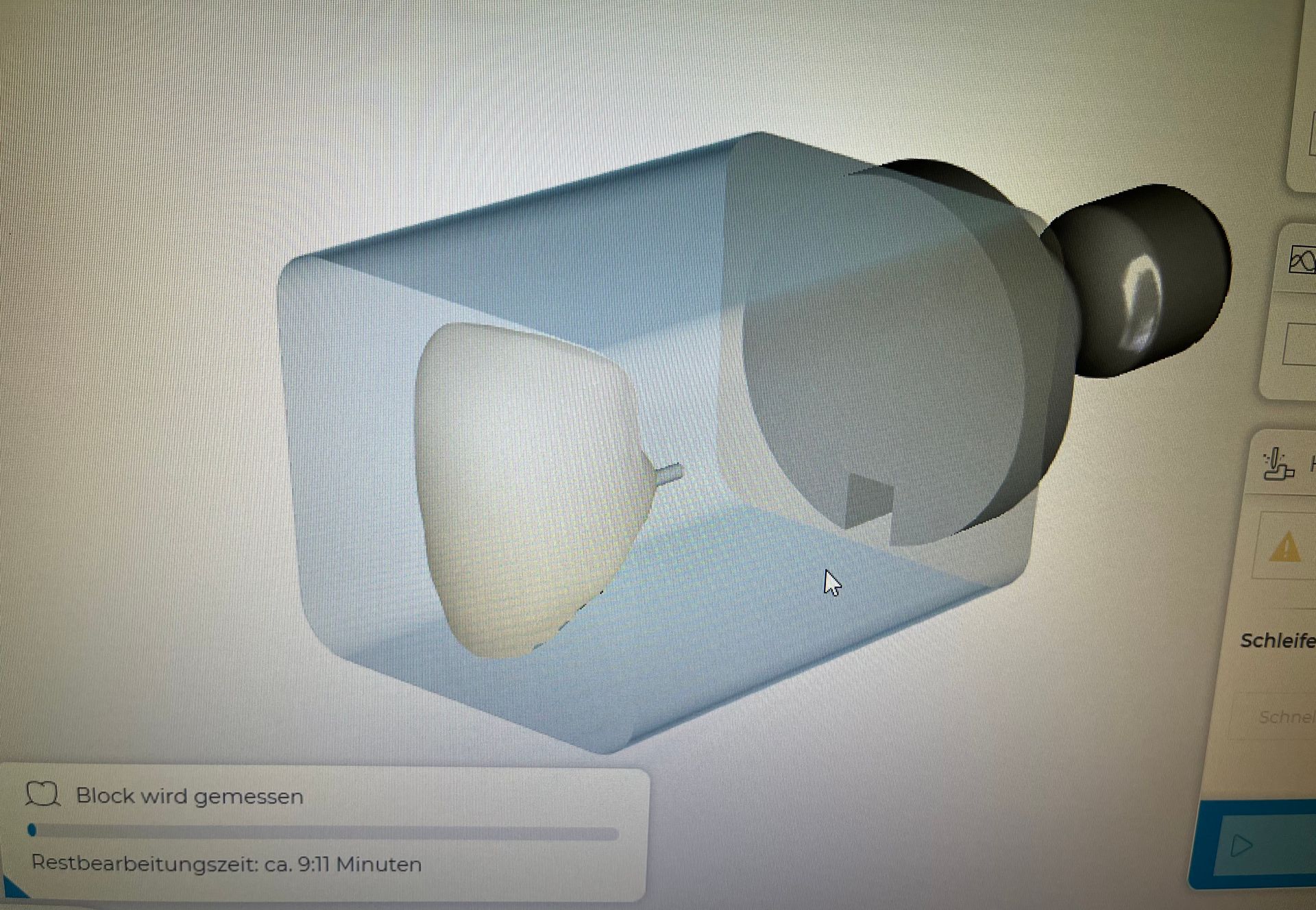 Ein Computerbildschirm zeigt ein 3D-Modell eines Zahns