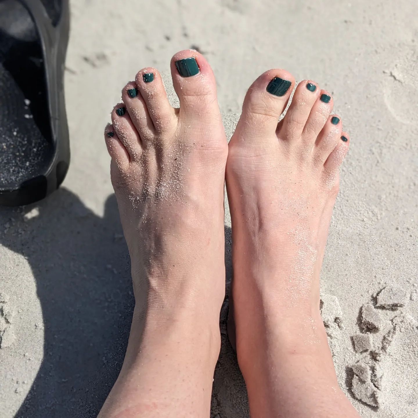 Woman's Feet — Jacksonville Beach, FL — McGuffin Smith Chiropractic
