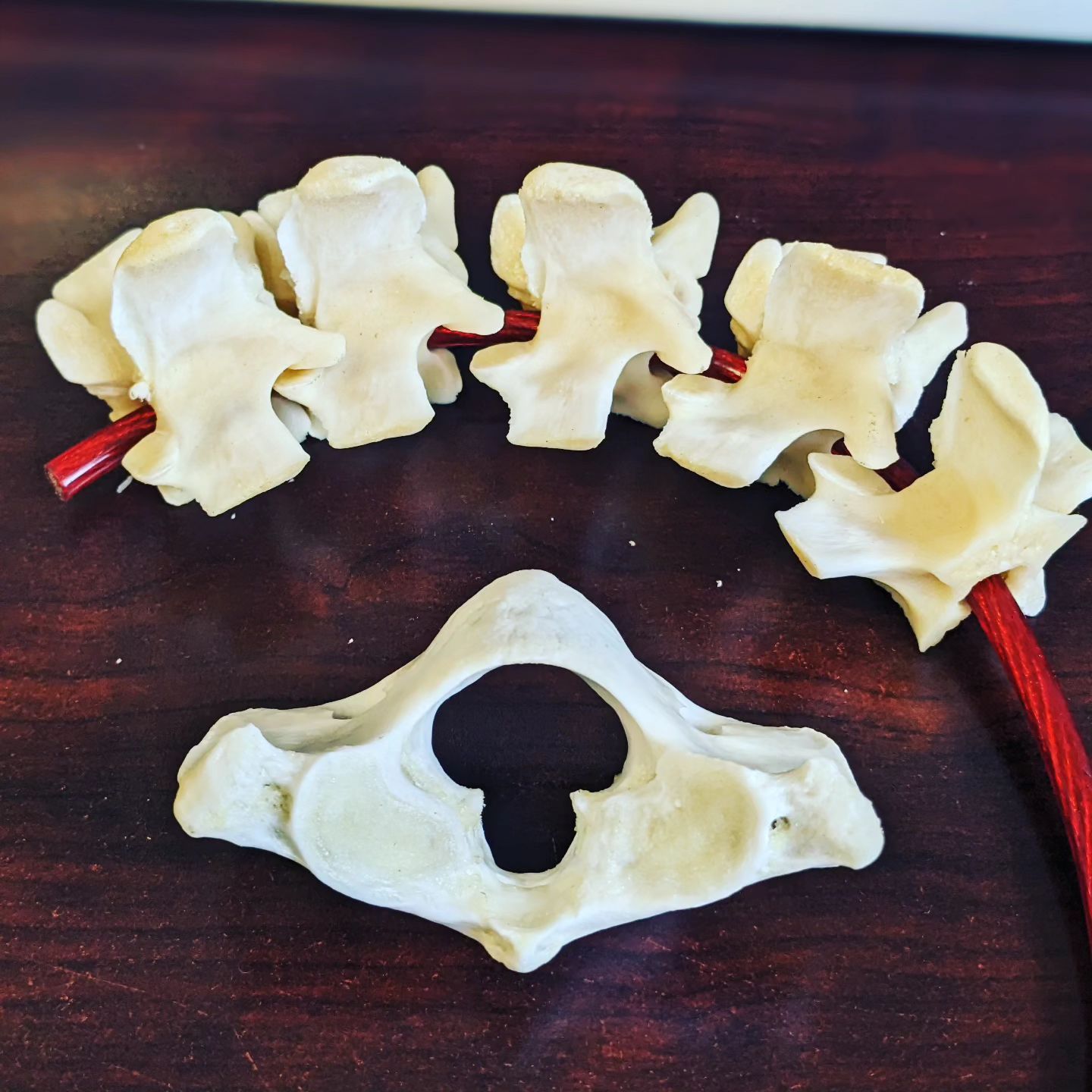 Chiropractic Bone — Jacksonville Beach, FL — McGuffin Smith Chiropractic