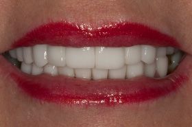 A close up of a woman 's mouth with red lipstick and white teeth.