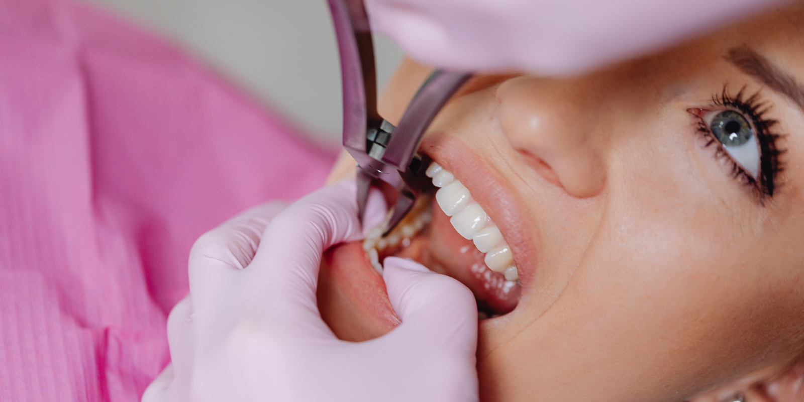 Close-up of dental tools examining teeth in a patient’s open mouth