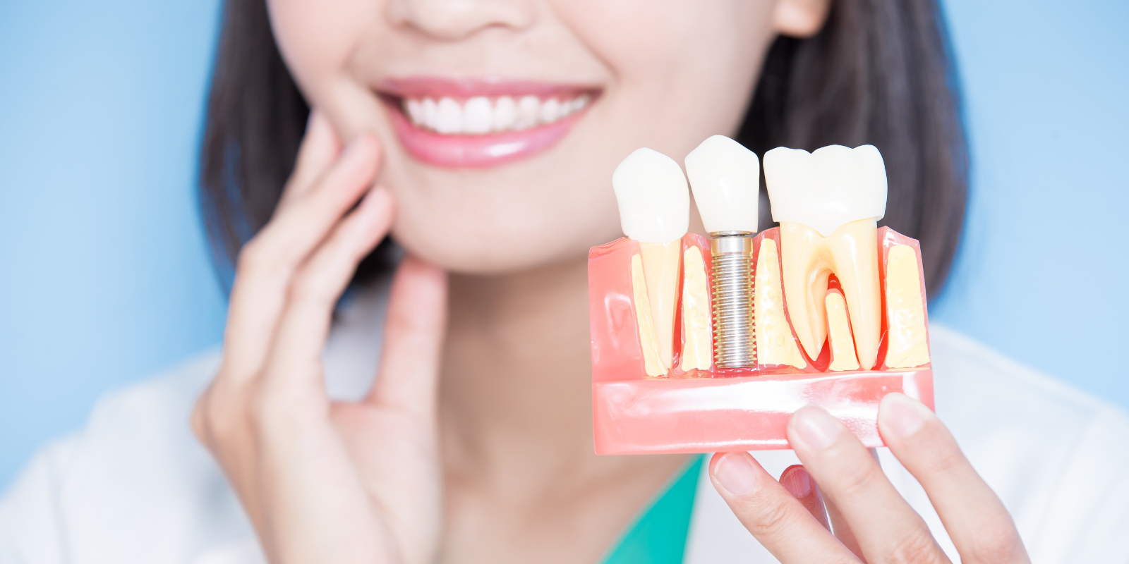 Woman smiling beside a dental implant model, showing gums and teeth on a pink base