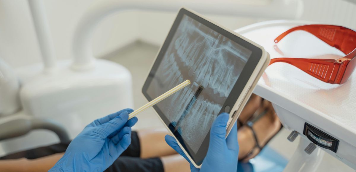 Gloved hands using a dental tool to inspect an X-ray on a tablet in a clinic