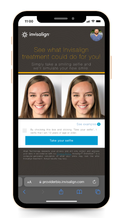 Mobile phone displaying an Invisalign advertisement with before/after photos of a woman's smile.