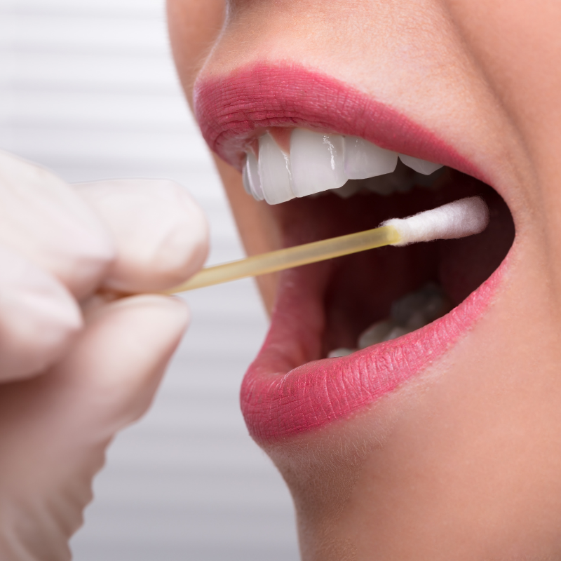 Cotton swab applying lipstick color to lips, showing dental or cosmetic testing