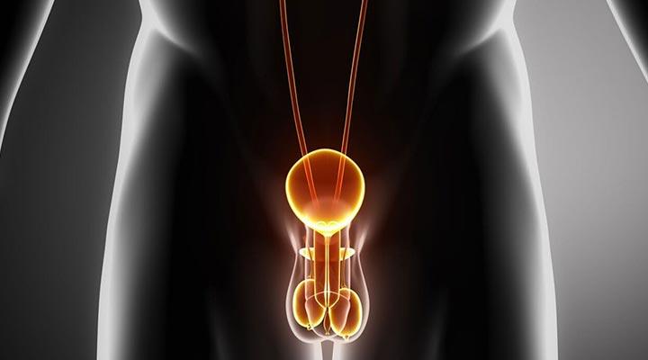 UNIDAD AVANZADA DE UROLOGÍA