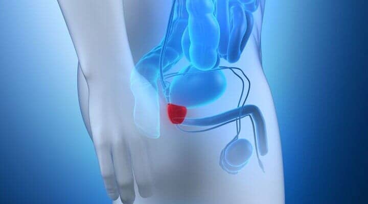 UNIDAD AVANZADA DE UROLOGÍA