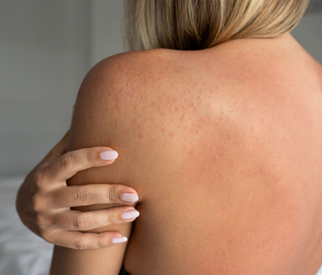 treatment for skin allergies in maryland