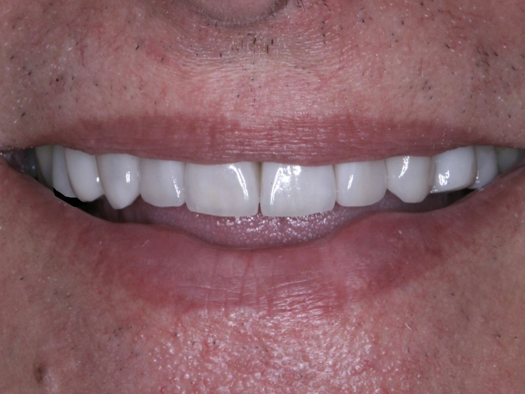 Upstate smiles dental service