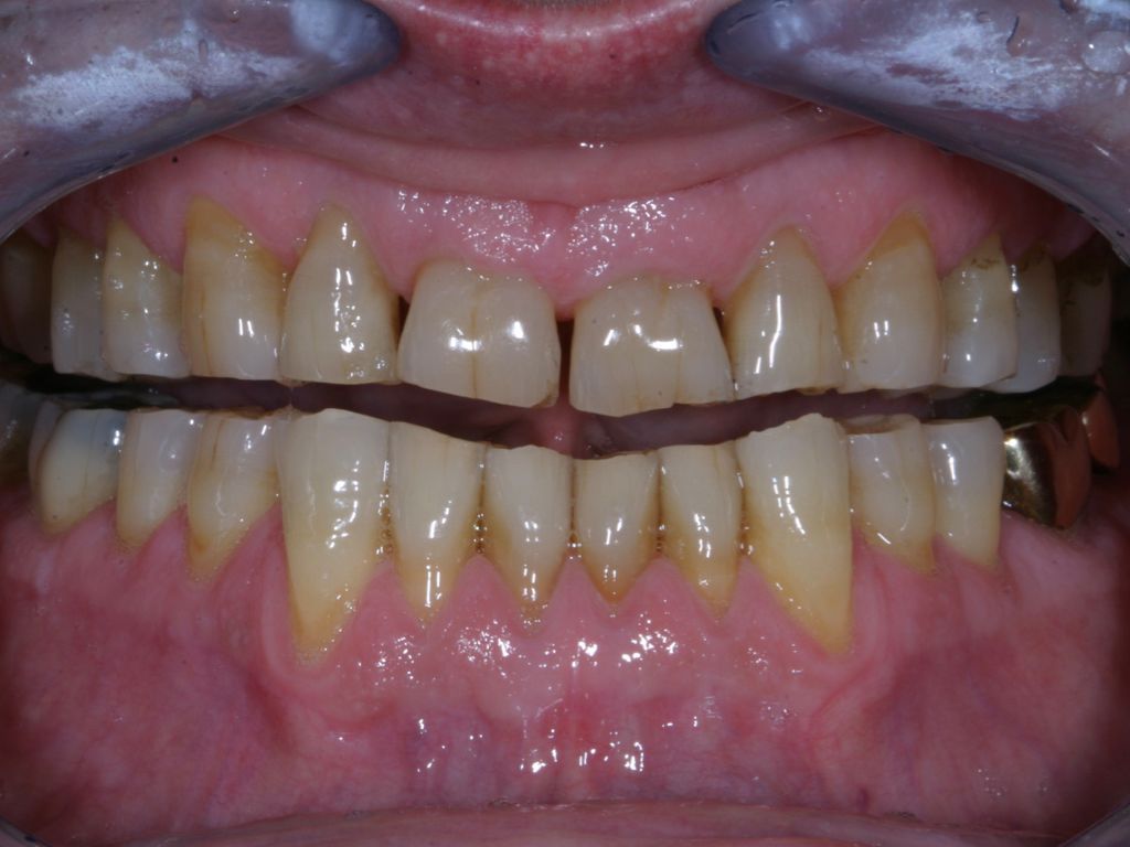 Upstate smiles dental service