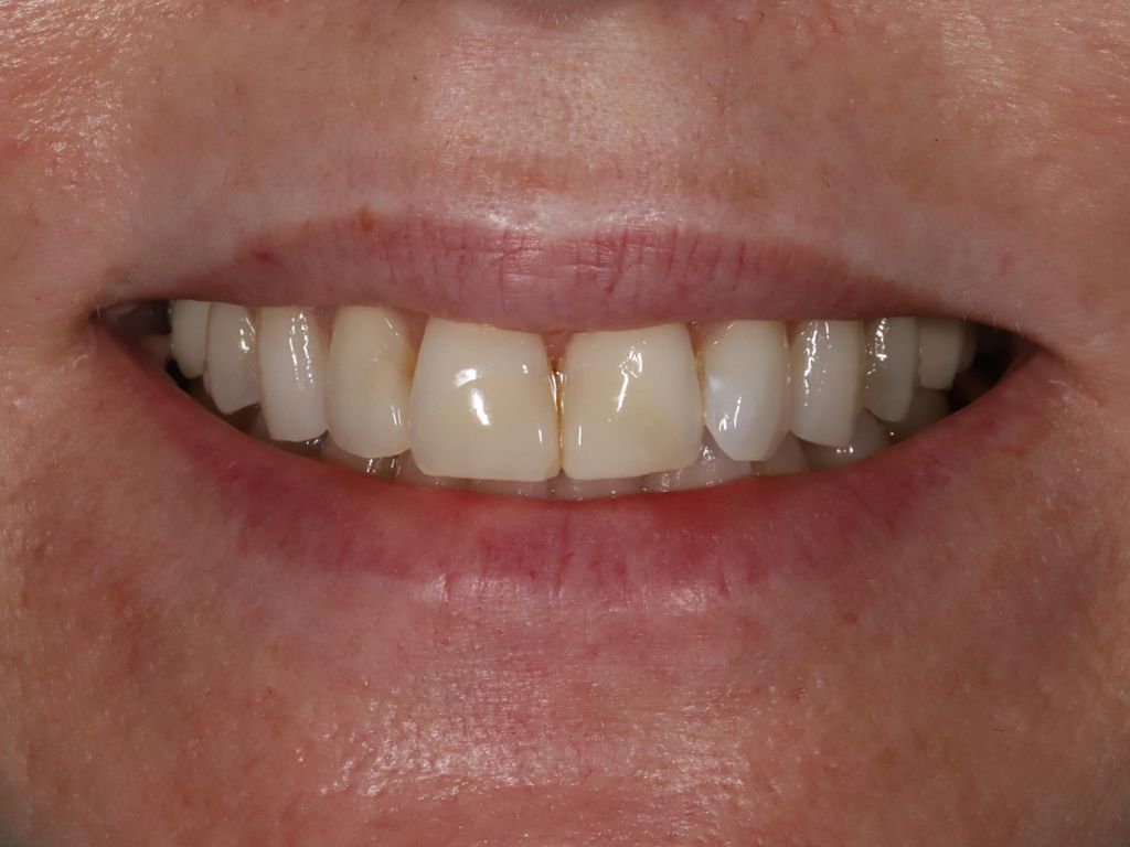 Upstate smiles dental service
