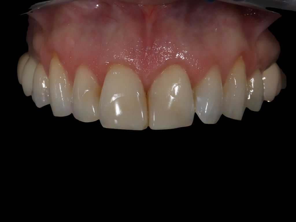 Upstate smiles dental service