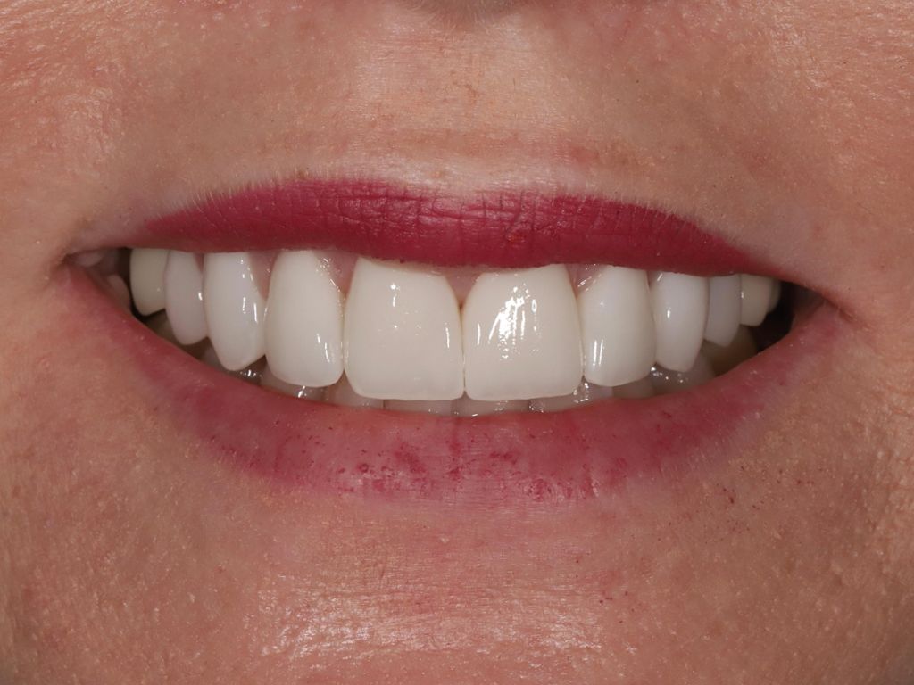 Upstate smiles dental service