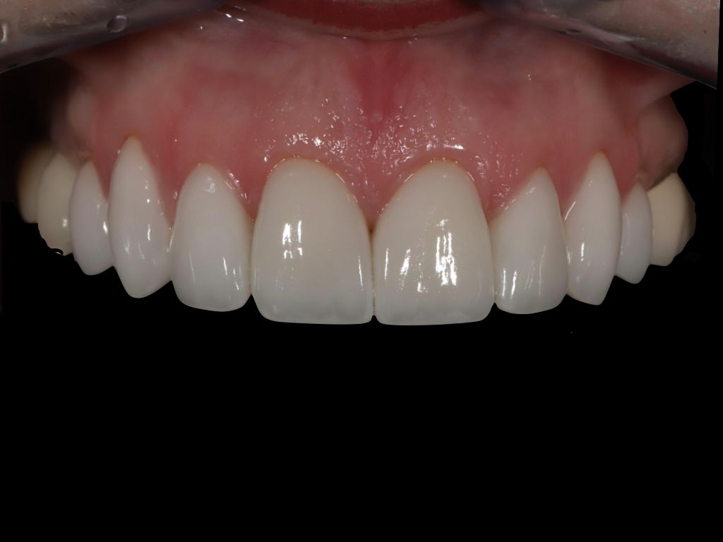 Upstate smiles dental service
