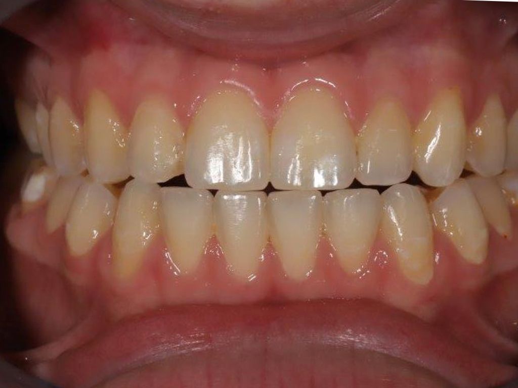 Upstate smiles dental service