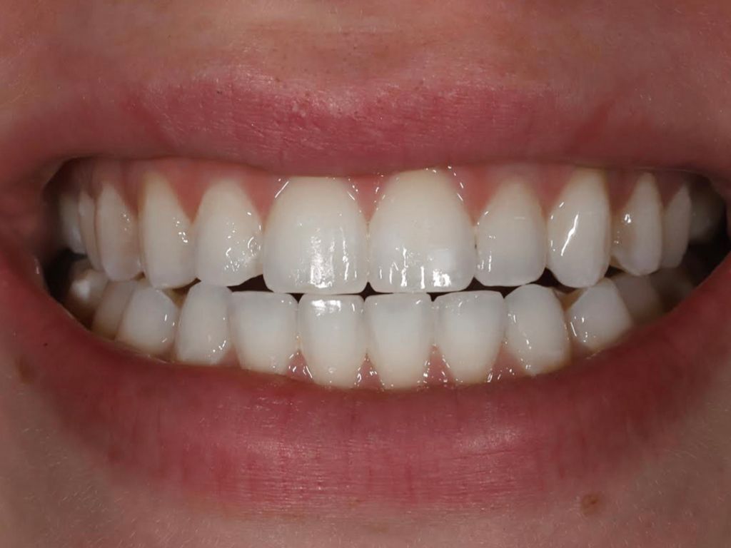 Upstate smiles dental service
