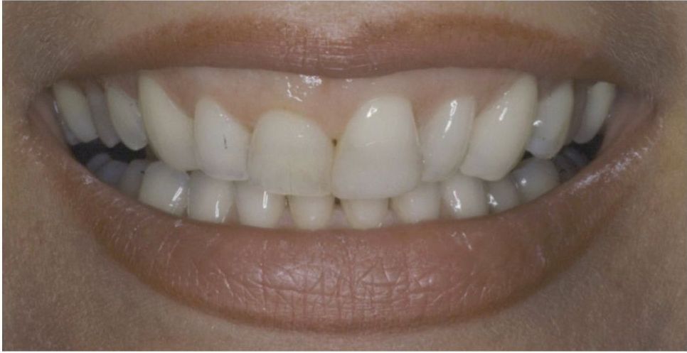 Upstate smiles dental service