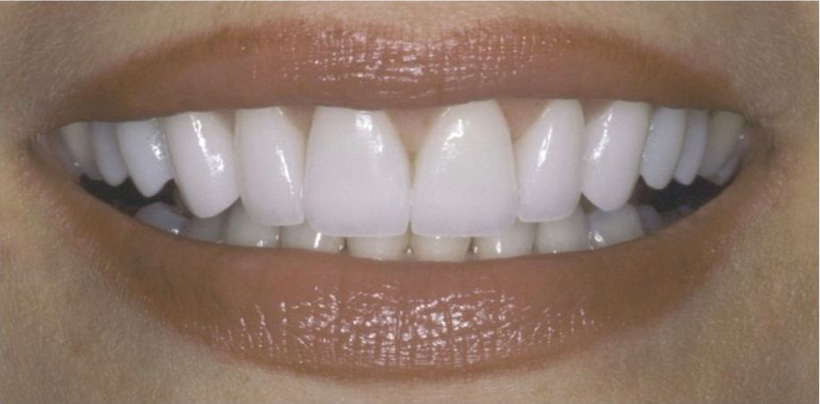 Upstate smiles dental service