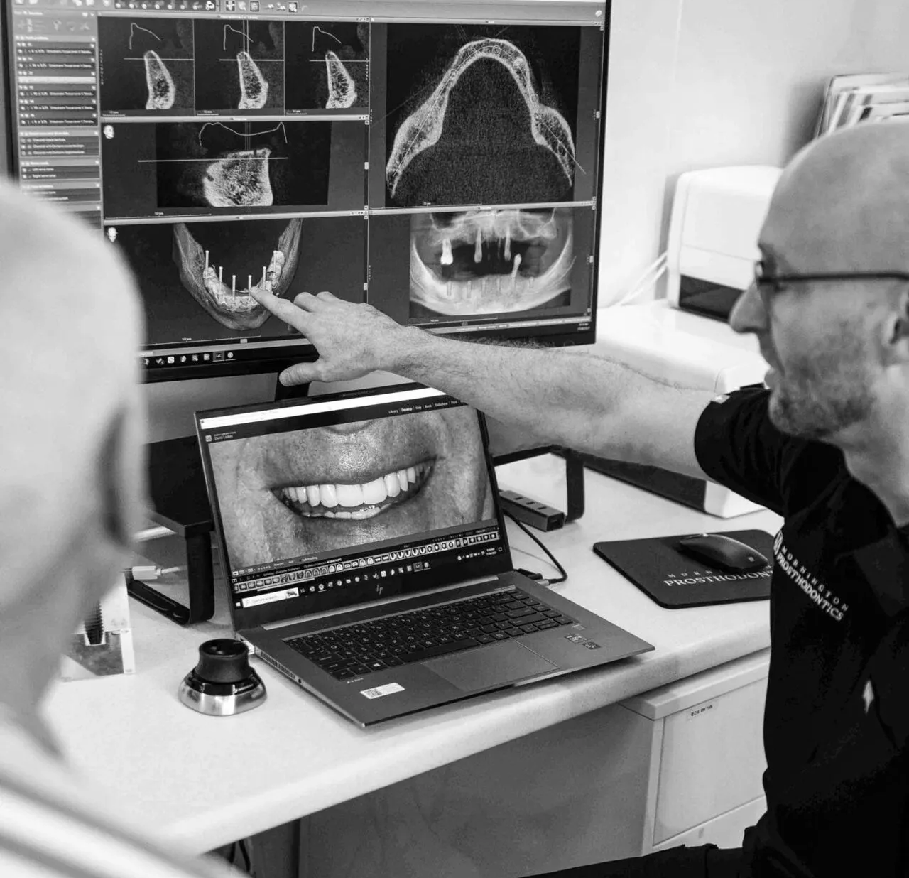 cosmetic dentist in simpsonville | Upstate Smiles