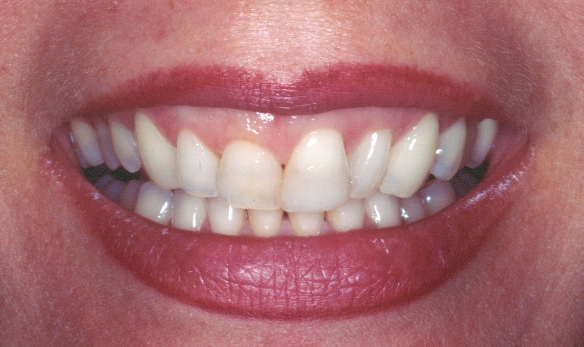 Upstate smiles dental service